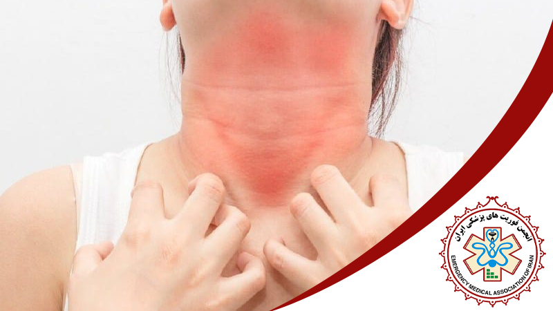 کمک‌ های اولیه در شوک آنافیلاکتیک